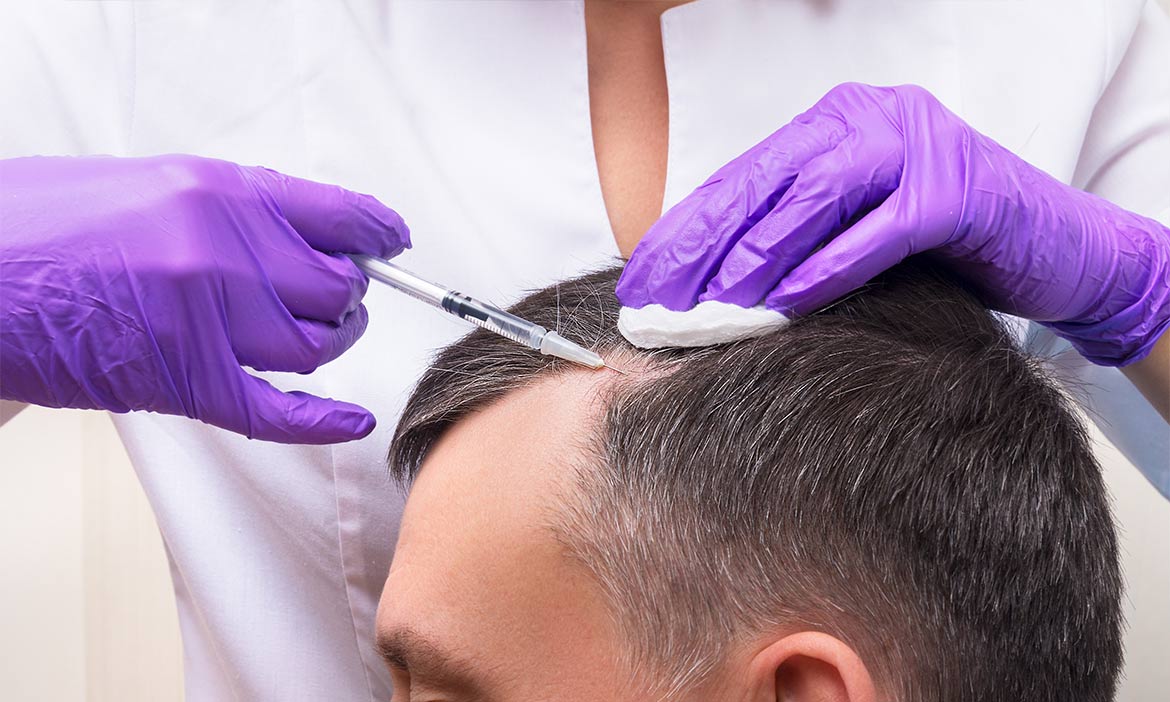 How PRP Therapy Works to Regrow Hair: Scientific Perspective